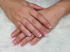 Nagelproblemen